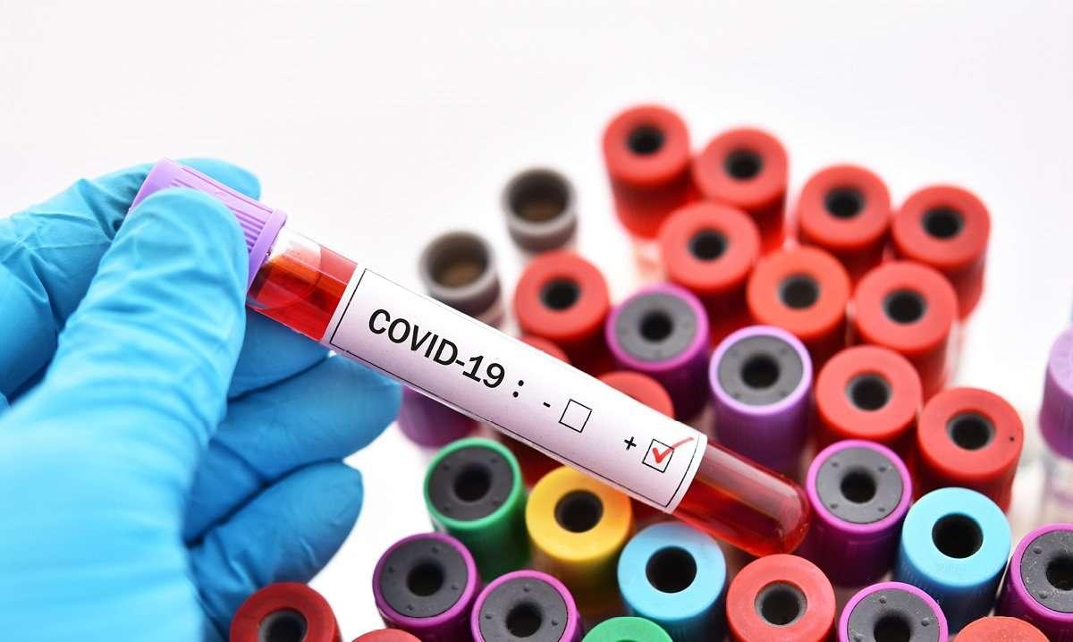 coronavirus