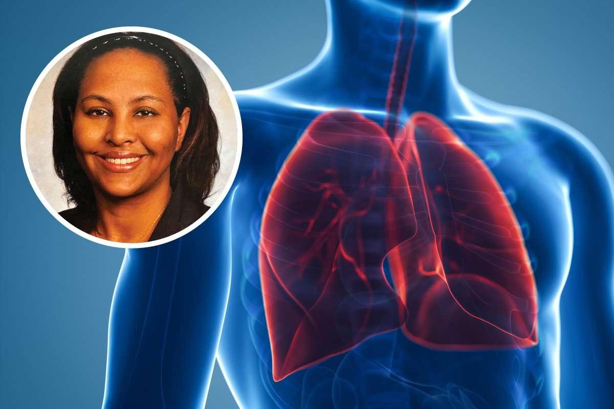 lung cancer
