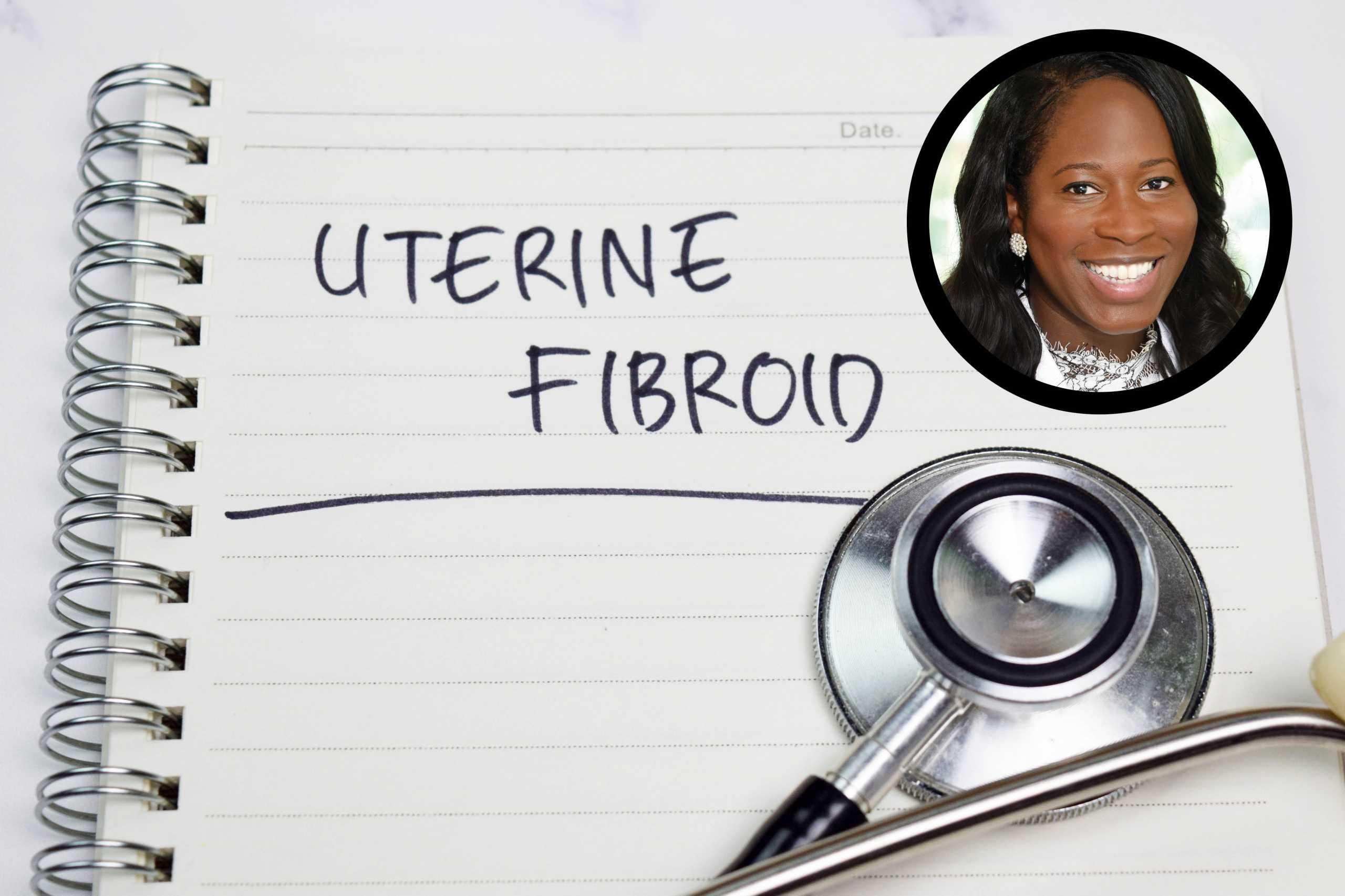 uterine fibroids
