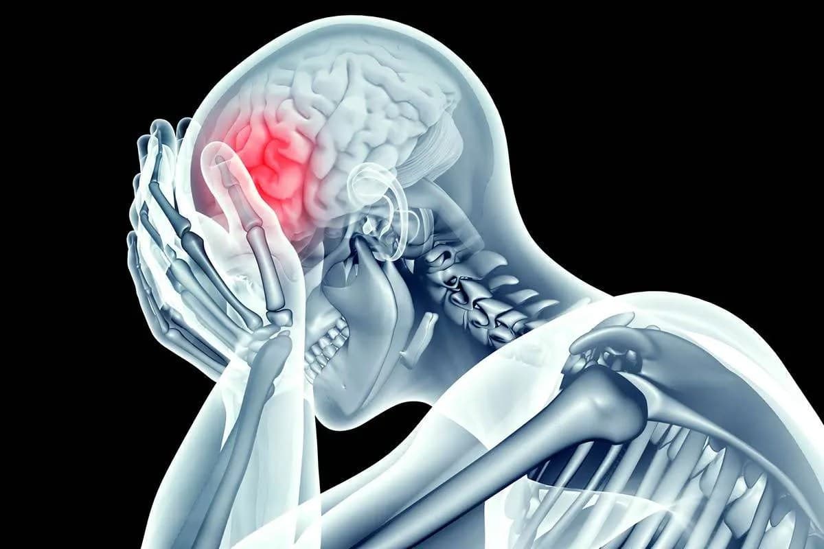 stroke